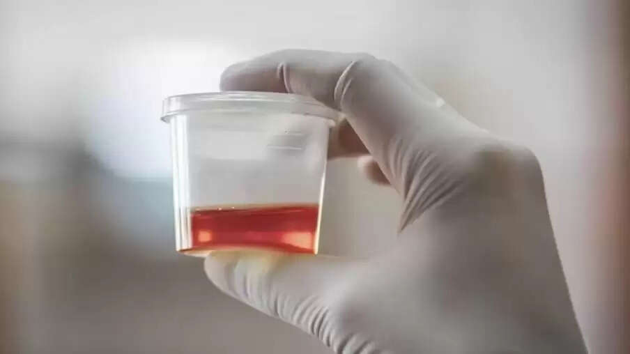 Urine