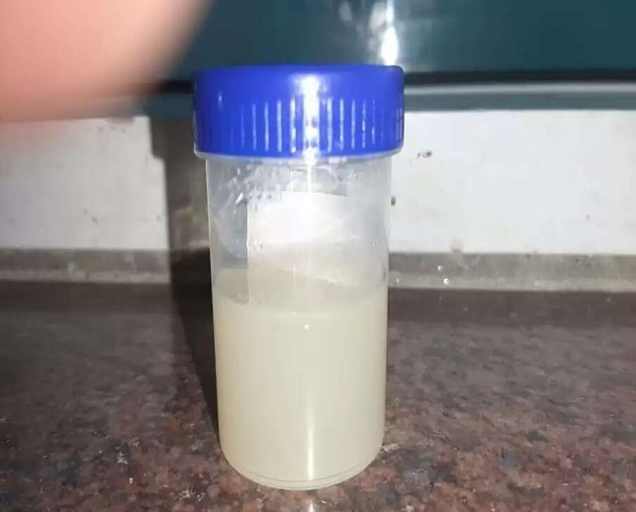 Urine