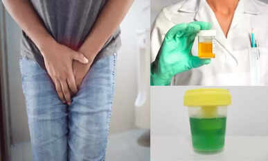 Urine