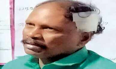 அதிமுக பிரமுகருக்கு அரிவாள் வெட்டு! பொதுமக்கள் உதவியுடன் உயிர் பிழைத்தார்!!