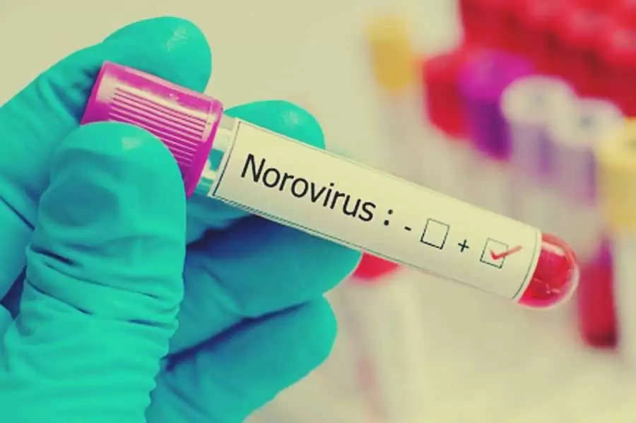 Noro virus