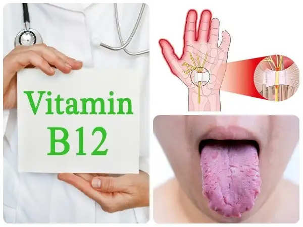 VItamin B12
